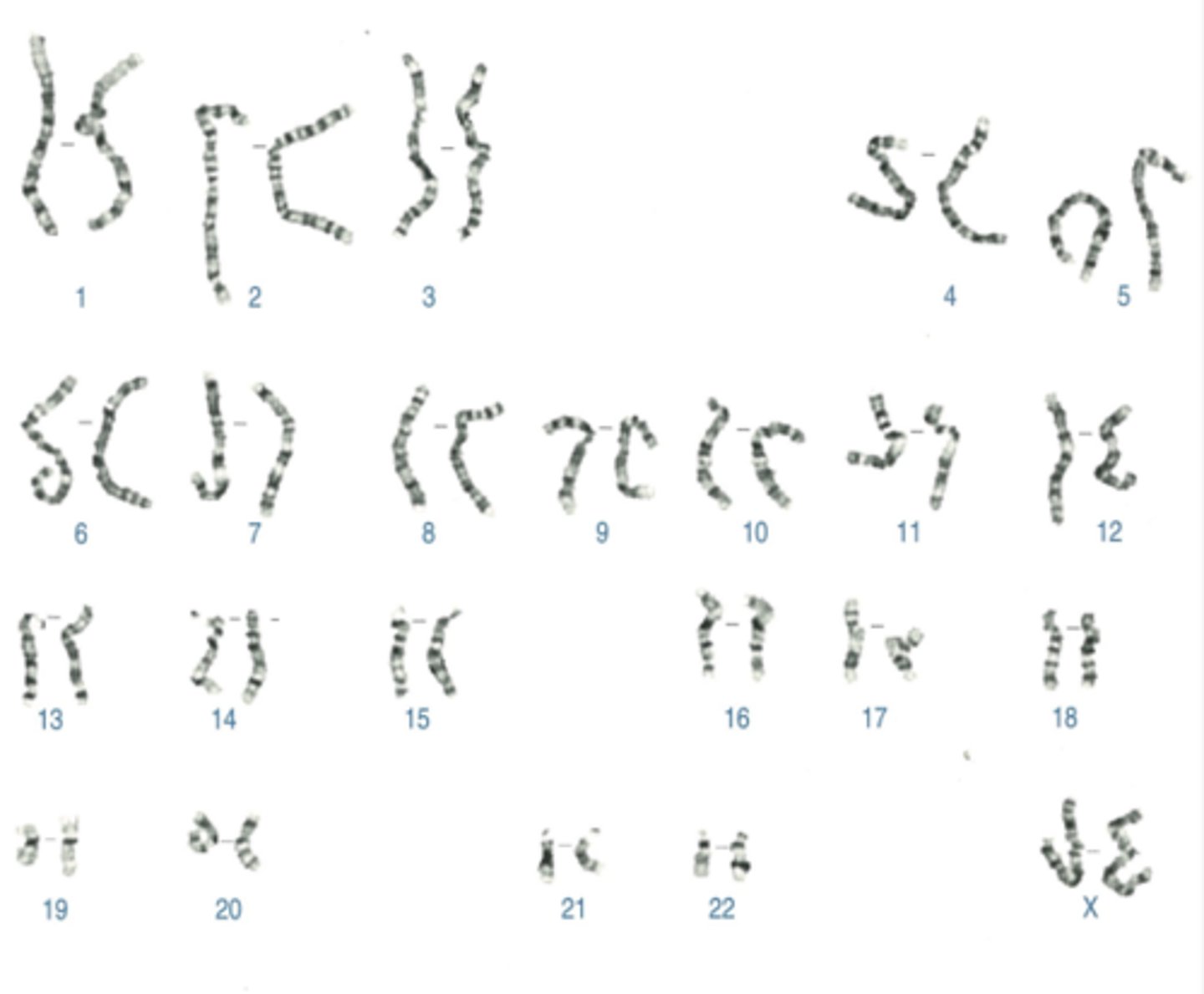 <p>Name:</p><p>- Correctly written karyotype</p><p>- Common name</p><p>- Scientific name</p><p>- One distinguishing clinical feature</p><p>- Definition of this feature if not obvious</p>