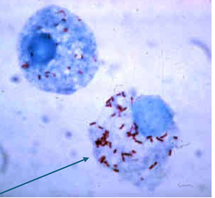 <p>Obligate intracellular giemsa stain</p>