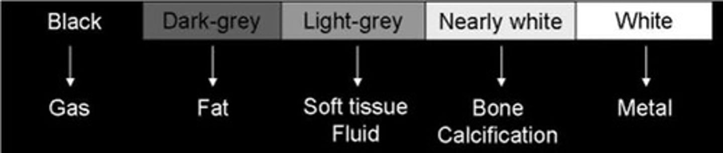 <p>1. Density</p><p>-air (black)</p><p>-fat (dark gray)</p><p>-fluid/soft tissue (light gray)</p><p>-calcium/bone (Nearly white)</p><p>-metal (white)</p><p>2. thickness</p><p>-the thicker it is, the brighter it appears</p><p>3. duration of exposure</p><p>-short=too bright</p><p>-long=too dark</p>