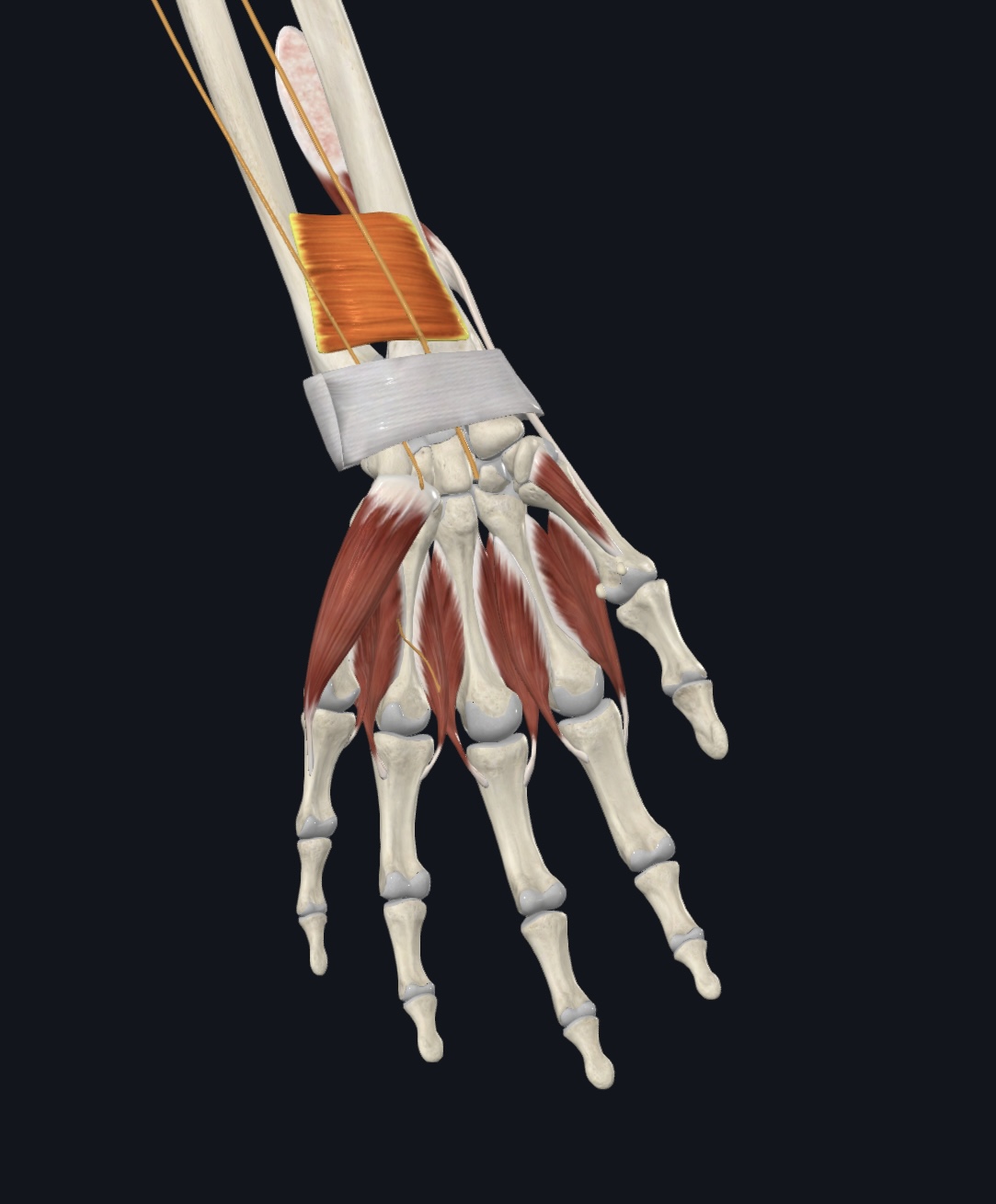 term image
