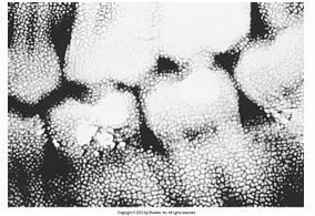 <p>What is the problem with this RETICULATION OF EMULSION X-ray?</p>