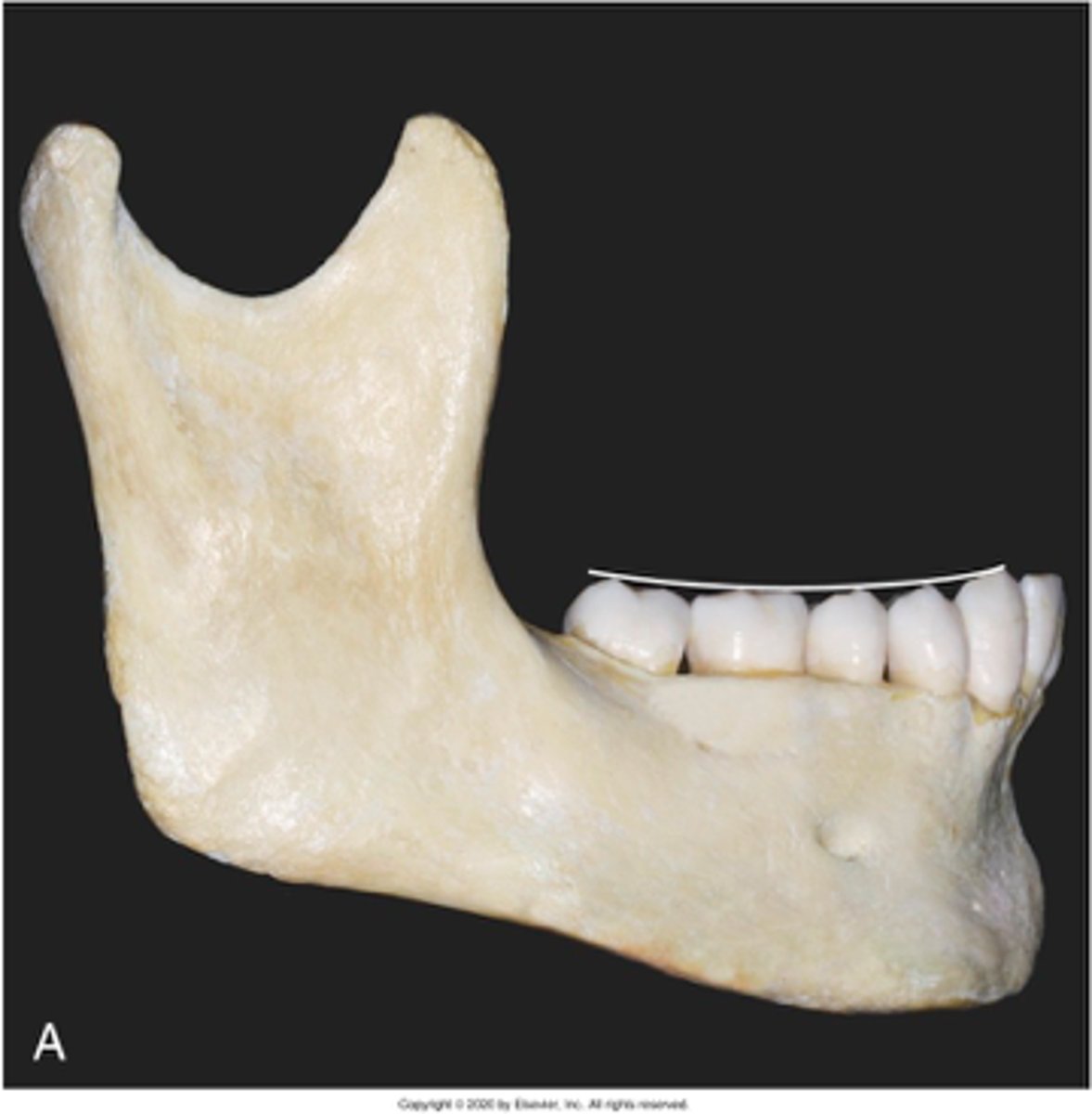 <p>which occlusal plane is observed?</p>