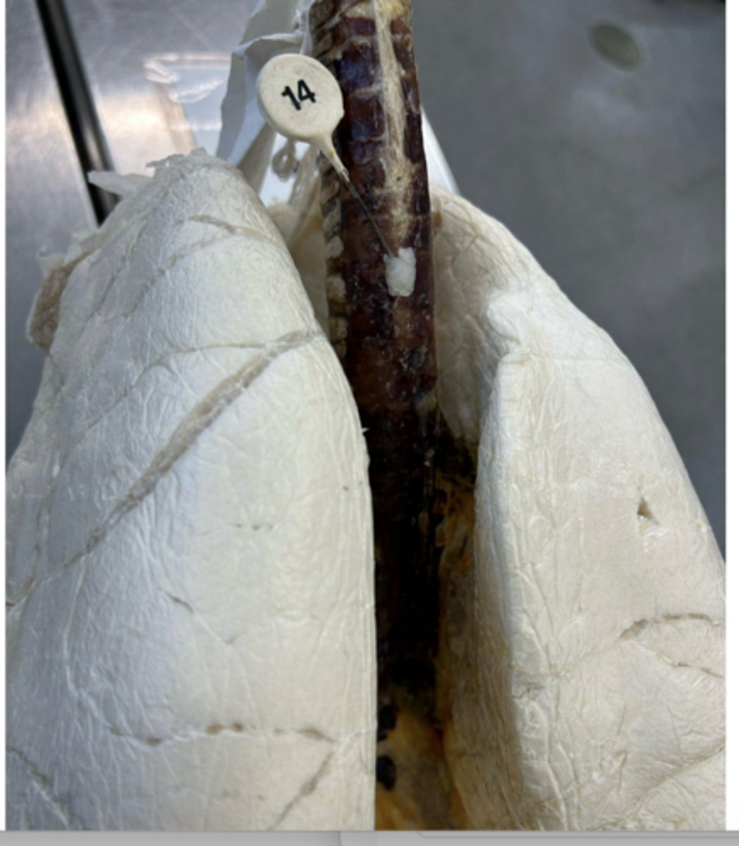 <p>From what domestic animal is this lung from?</p>