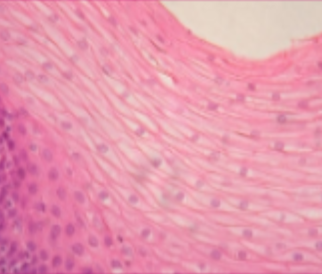 <p>What kind of epithelial tissue is this?</p>