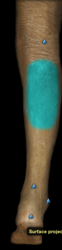 Formed by surface projection of gastrocnemius and soleus muscles