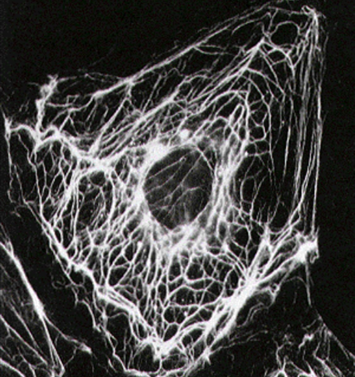 <p>what cytoskeletal structure is this?</p>