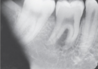 <p>What causes<strong> light leak</strong>? </p>