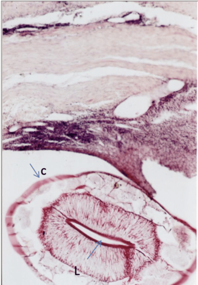 <p>What is this parasite? What characteristic/s did you use to identify it? (within mesenteric artery)</p>
