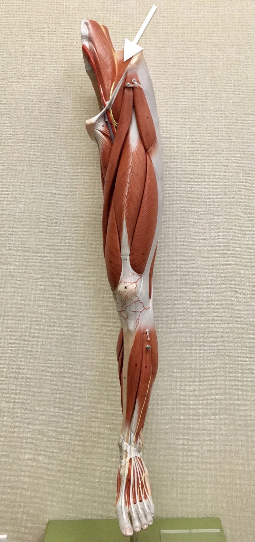 <p><span>Name the muscle labeled with the white arrow below:</span></p>