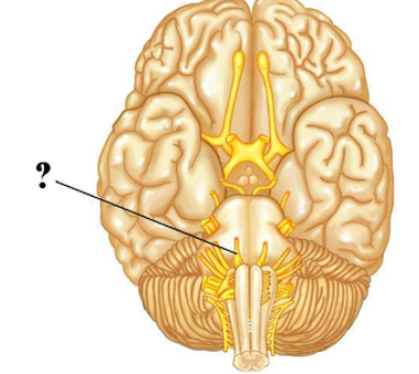 <p><span><span>Identify the indicated cranial nerve.</span></span></p>