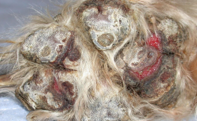 <ul><li><p><span style="color: rgb(136, 136, 136);"><strong>AKA:</strong></span><strong> Necrolytic migratory erythema, hepatocutaneous syndrome, metabolic epidermal necrolysis</strong></p></li><li><p><span style="color: rgb(136, 136, 136);"><strong>Et:</strong></span><strong> </strong><u>nutritional imbalance (hypoaminoacidemia) due to hyperglucagonemia, liver dysfunction</u></p></li><li><p><span style="color: rgb(136, 136, 136);"><strong>Sig: </strong></span>older dogs</p></li><li><p><span style="color: rgb(136, 136, 136);"><strong>Cs:</strong></span> <u>PU/PD, crusted erosions/ulcers → painful, high liver enzymes,&nbsp; hyperglycemia</u></p><ul><li><p>muzzle, mucocutaneous junctions, distal limbs, pawpads</p></li></ul><img src="https://knowt-user-attachments.s3.amazonaws.com/f4f07231-e24f-4a12-8a9f-047391fdd753.png" data-width="50%" data-align="center"></li><li><p><span style="color: rgb(136, 136, 136);"><strong>Dt:</strong></span><strong> <u>“red, white, blue”</u></strong> pattern (parakeratotic hyperkeratosis + keratinocyte vacuolation + basal hyperplasia) : thickened basal layer</p></li><li><p><span style="color: rgb(136, 136, 136);"><strong>Tx:</strong></span><strong> </strong>amino acid supplementation</p><ul><li><p>poor prognosis</p></li></ul></li></ul><p></p>