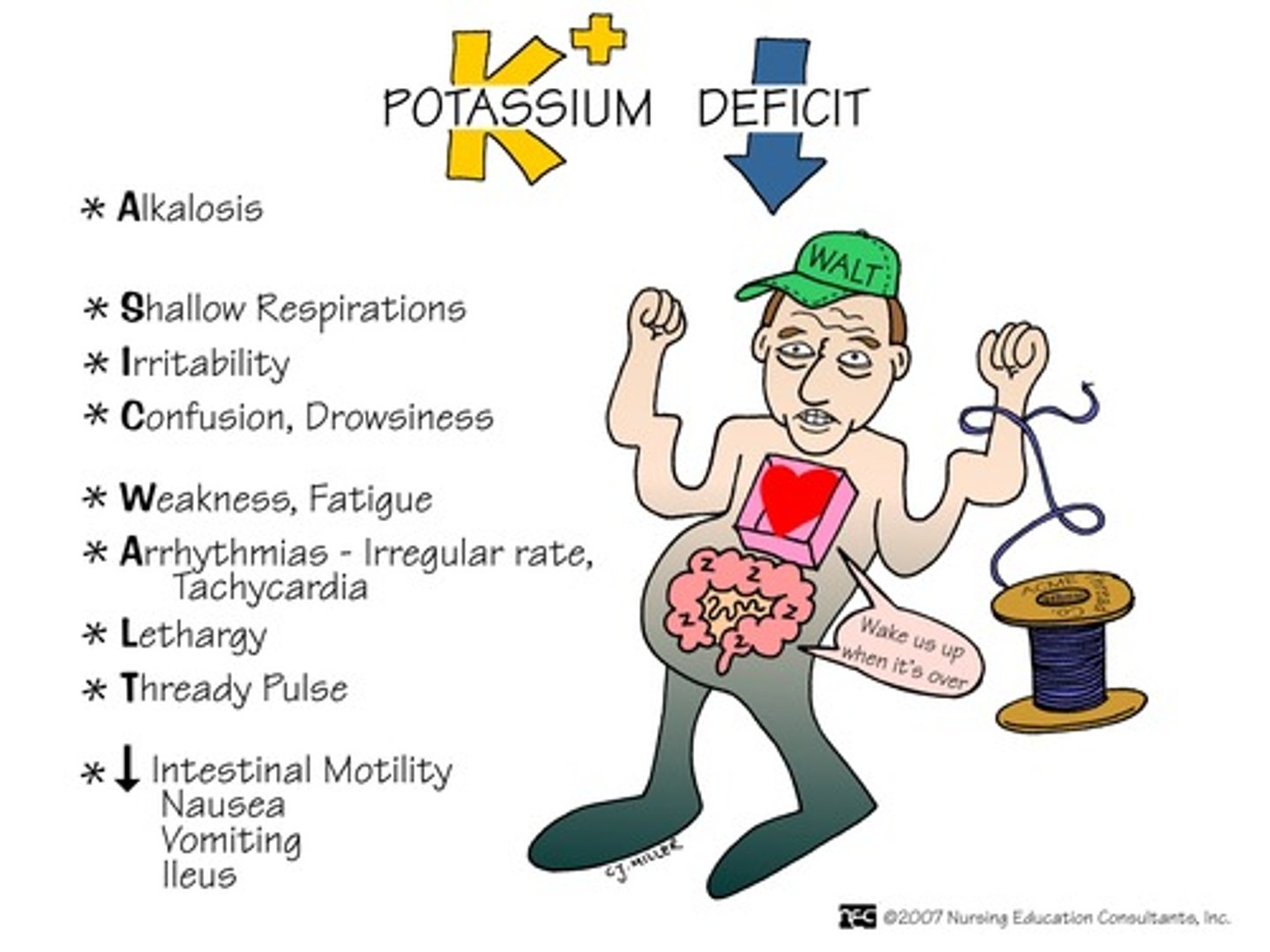 <p>Alkalosis</p><p>Shallow respirations</p><p>dysrhythmias</p><p>Confusion, drowsiness, lethargy</p><p>Weakness and fatigue</p><p>Arrhythmias-tachycardia and irregular heart beat</p><p>Lethargy</p><p>Thready pulse</p><p>Intestinal Motility decreased (abd distension, ileus, N and V)</p>