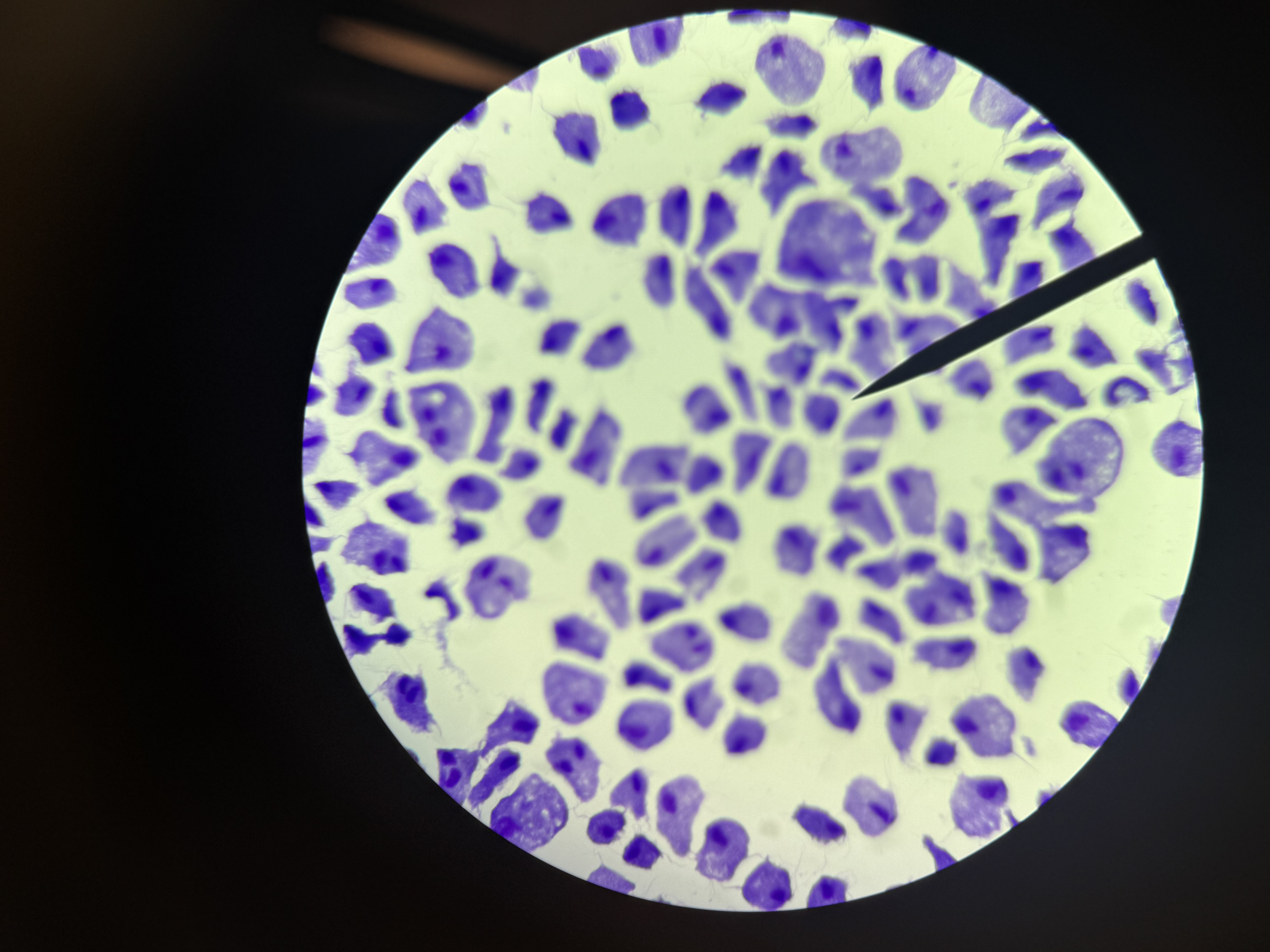 <p>Trichomonas vaginalis</p>