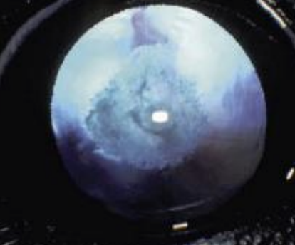 <p>Can cataracts be inherited in some dog breeds, and metabolic in other cases, like in calves?</p>