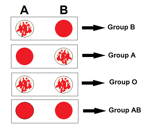 <p>Classifies blood according to the presence of major antigens A, B on RBC surfaces and to serum antibodies anti-A and anti-B</p>