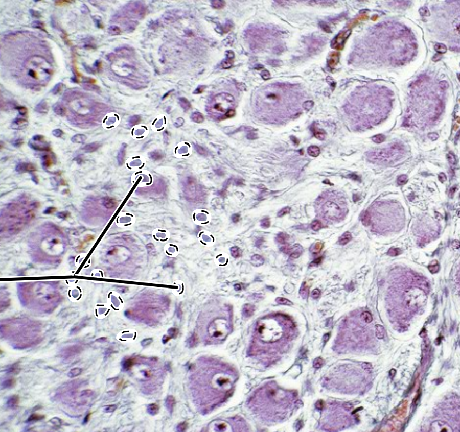<p>glial cell type in the PNS that provides support for neurons in the ganglia</p>