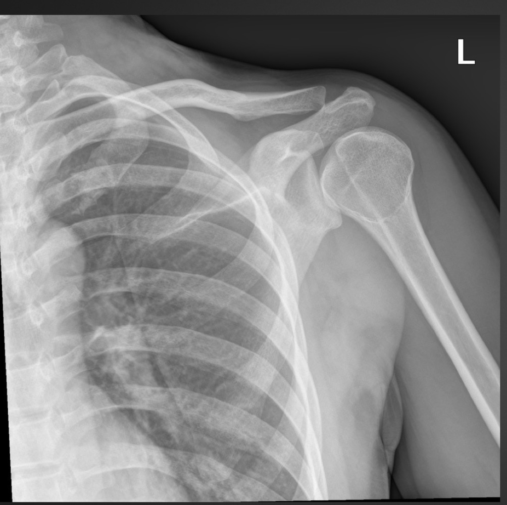 <p>what is this anomaly called </p>