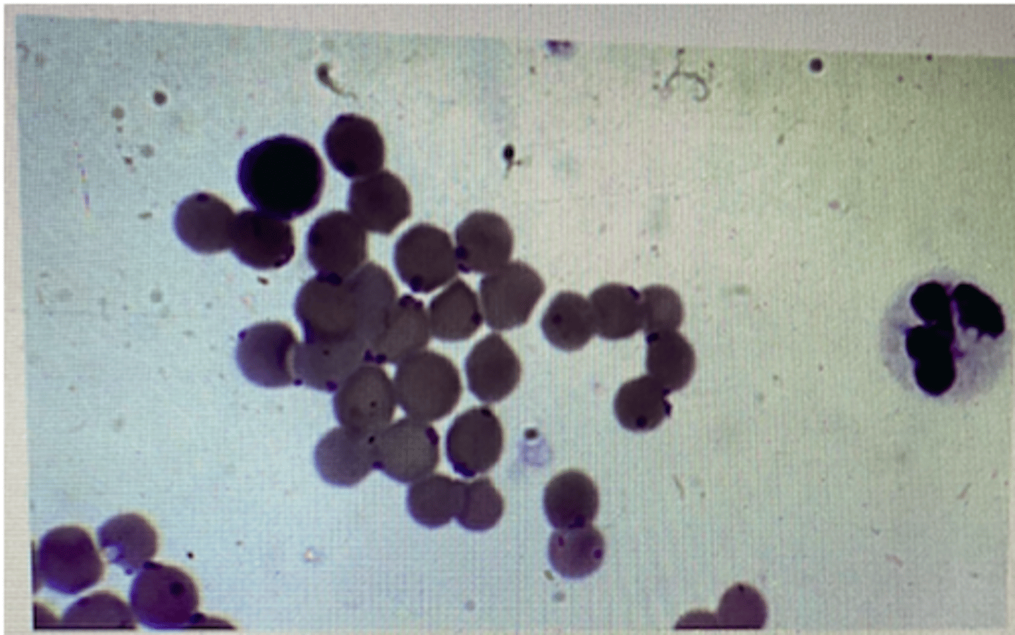 <p>What is the diagnosis for a blood smear from a cat?</p><p>a. FPV</p><p>b. FIV</p><p>c. Feline orthopoxvirus</p><p>d. FIA</p><p>e. FeLV</p>