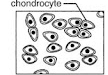 <p>What type of cartilage is shown in the picture?</p>