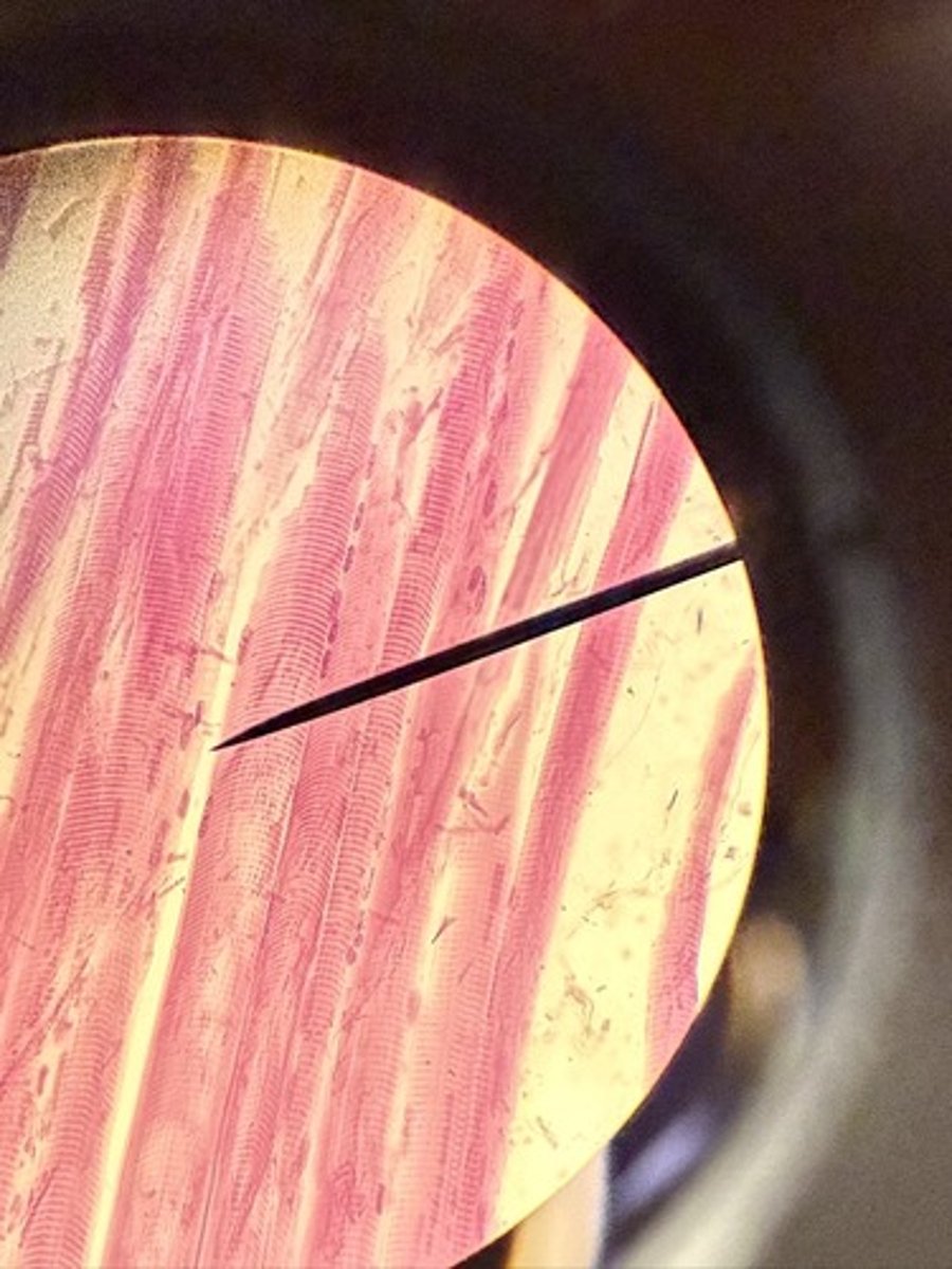 <p>Cardiac muscle</p>