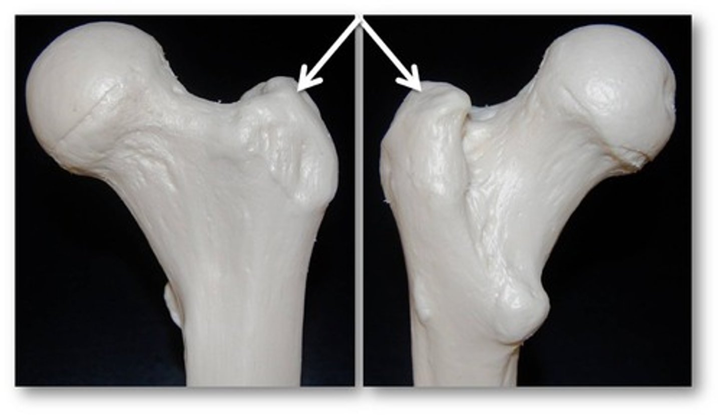 <p>Name this specific part of the femur.</p>