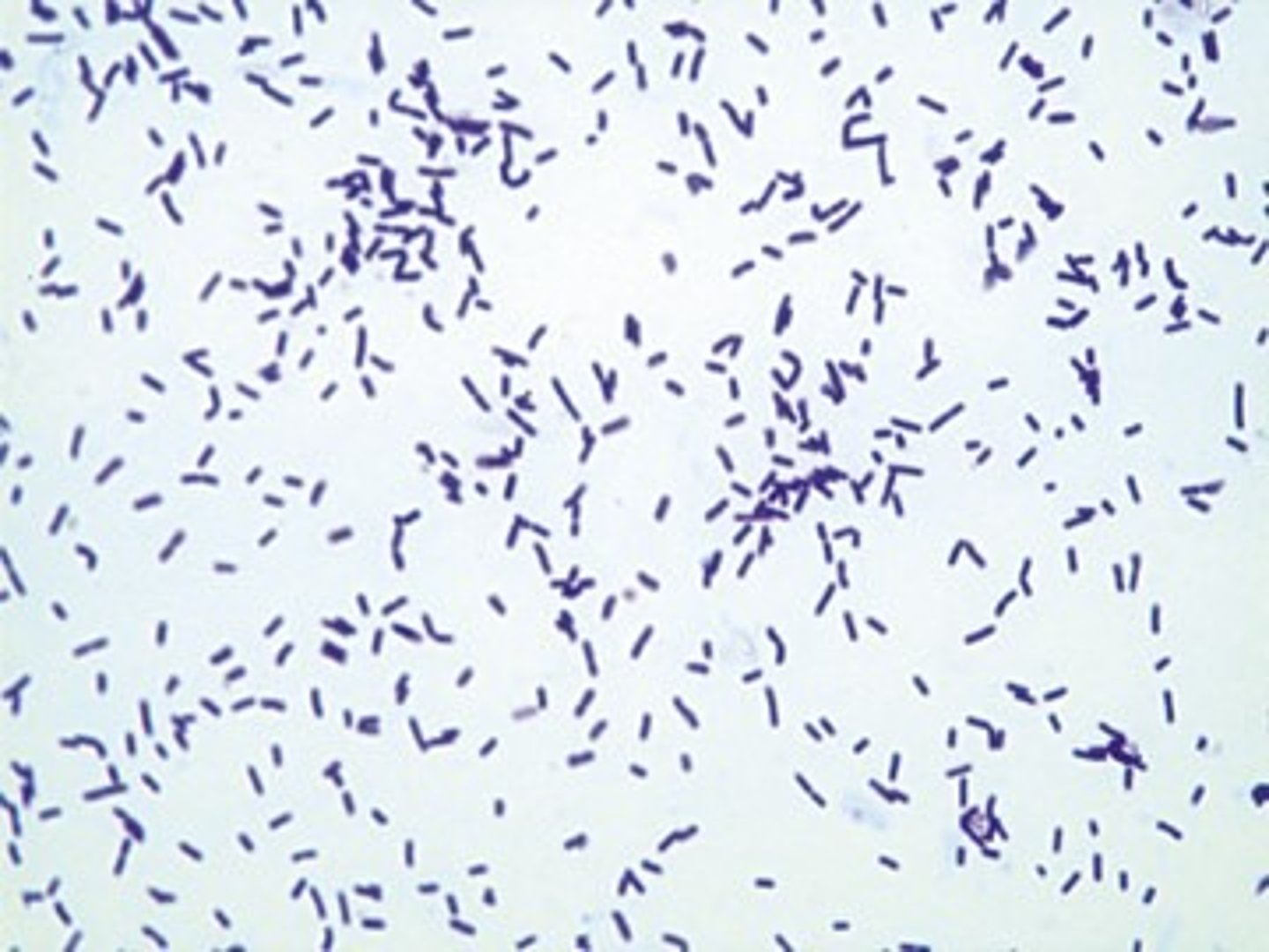 <p>- +ve rod</p><p>- facultative anaerobes</p><p>- found in OC &amp; GIT; contributes to oral health</p><p>- rarely pathogenic but can cause bacteremia in immunocompromised pts</p><p>- prod lactic acid; catalase -ve</p>