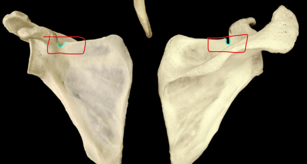 <p>what part of the scapula is highlighted</p>