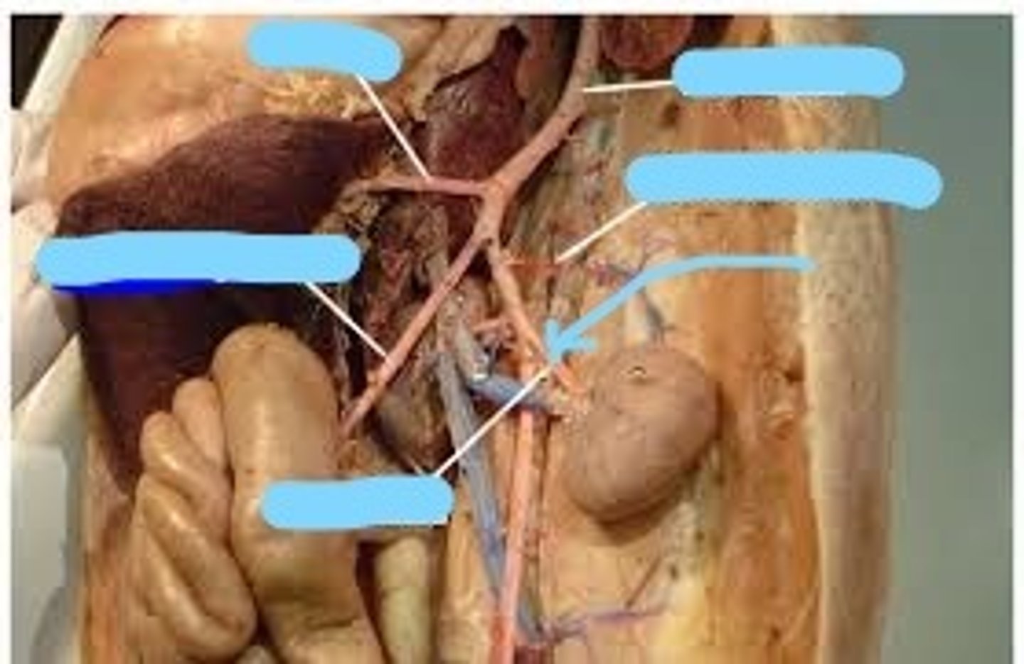 <p>supplies kidneys</p>