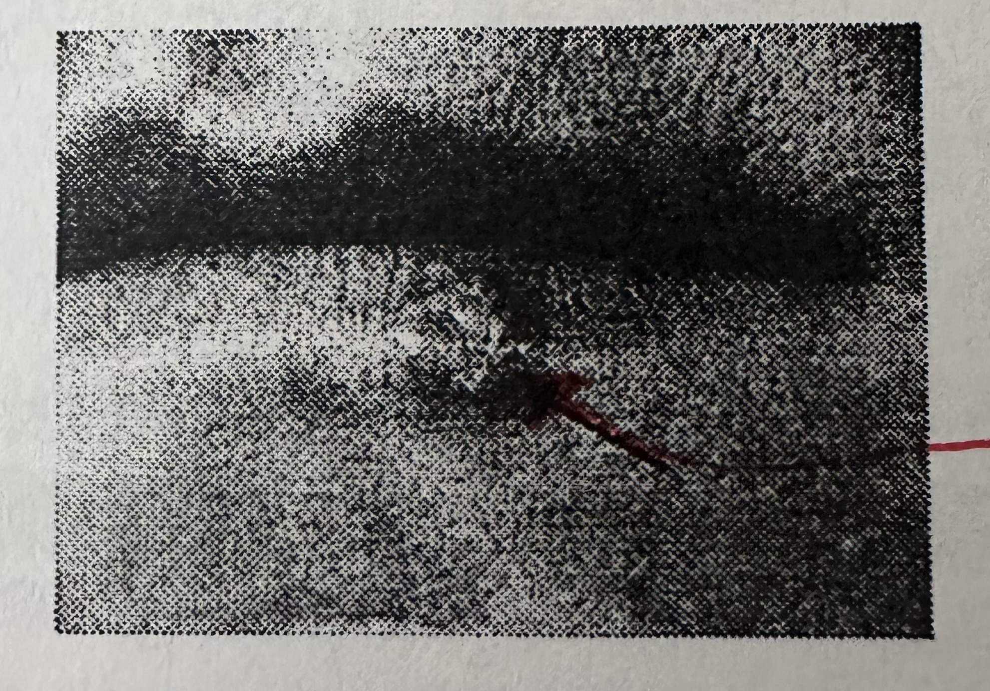 <p>remain latent until some sort of physical or emotional stress triggers a new round of active <strong>active.</strong> Infection of other cells causes cold sores.</p>