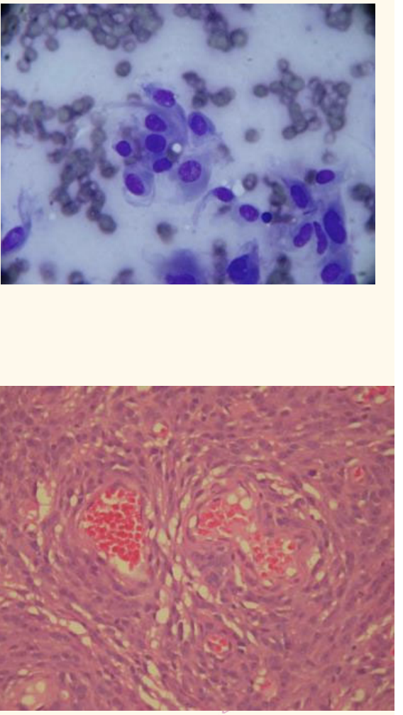 <p>Soft tissue sarcomas</p><ul><li><p><strong>malignancy/ aggressiveness?</strong></p></li><li><p>how do you confirm behaviour?</p></li><li><p><u>LN metastasis?</u></p></li></ul><p></p>