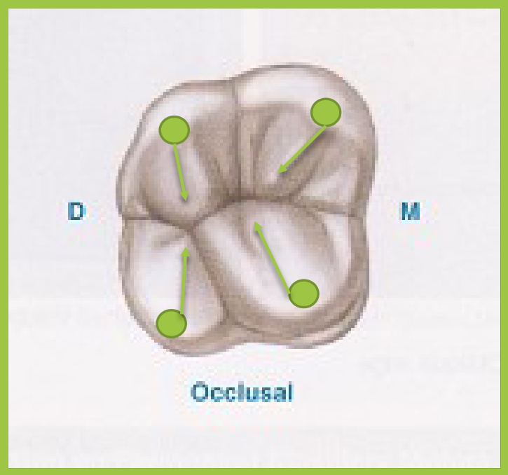 <p>what are the arrows?</p>