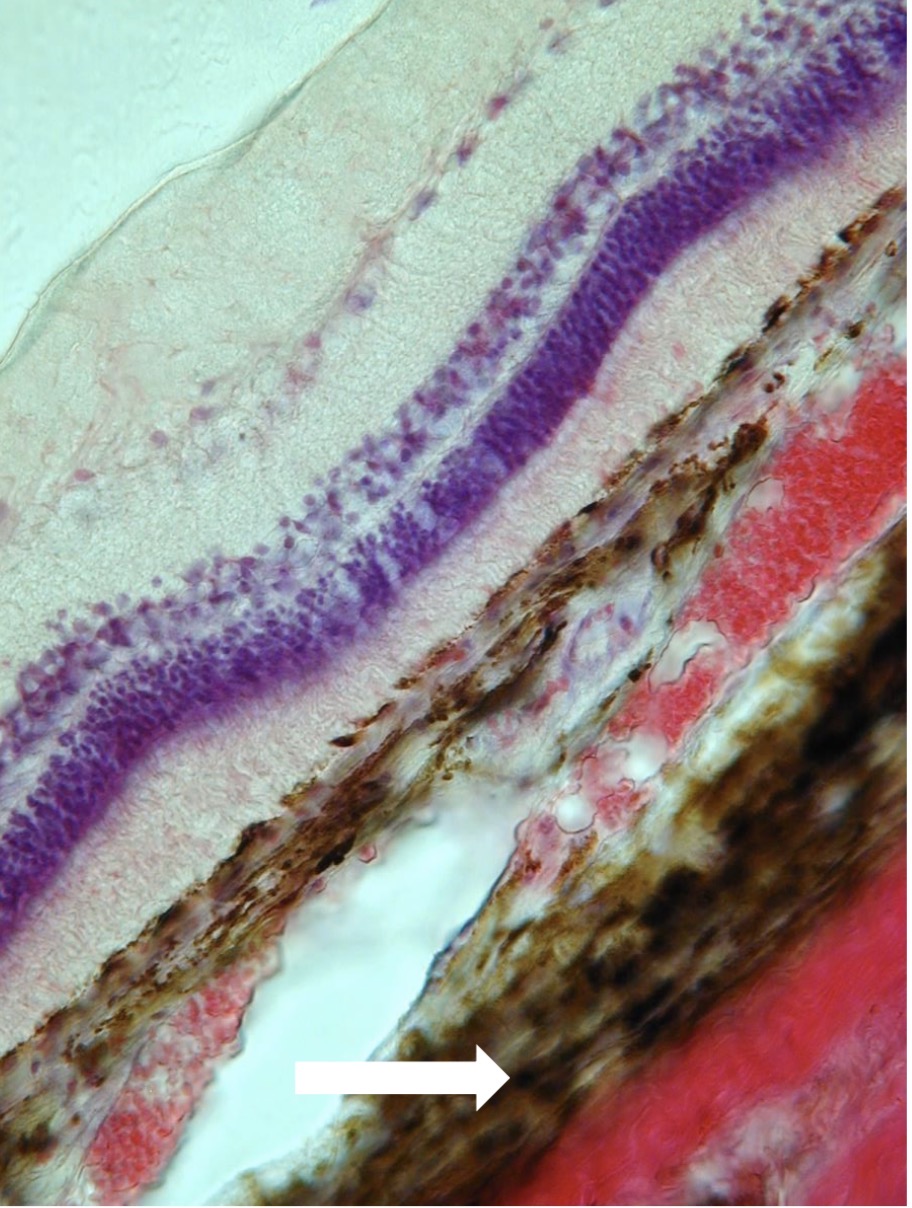 <p>Puriojo jungiamojo</p>