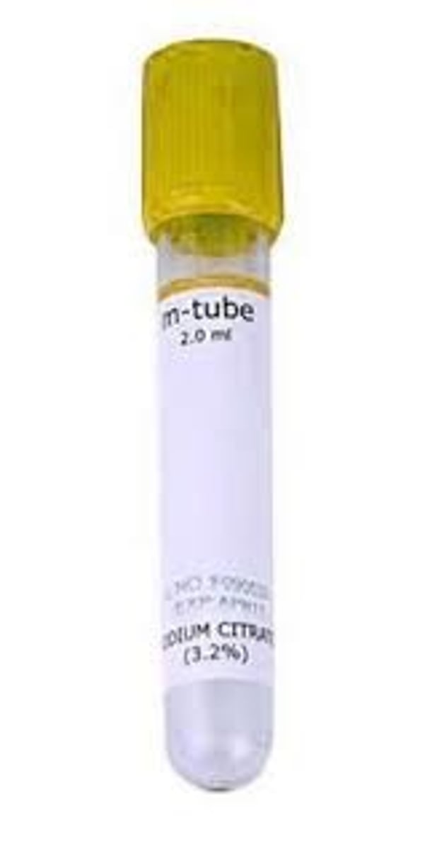 <p>sodium polyanethol sulfonate (sps)</p>