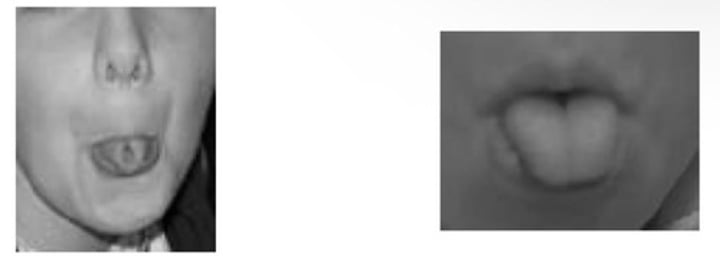 <p><strong>Rolling</strong></p><p><span class="bgP">- dominant</span></p><p></p><p><strong>Non-rolling</strong></p><p><span class="bgP">- recessive</span></p>