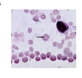 <p>Schizogony in lymphocytes and invades RBCs </p><p>one of the most important disease in cattle</p>