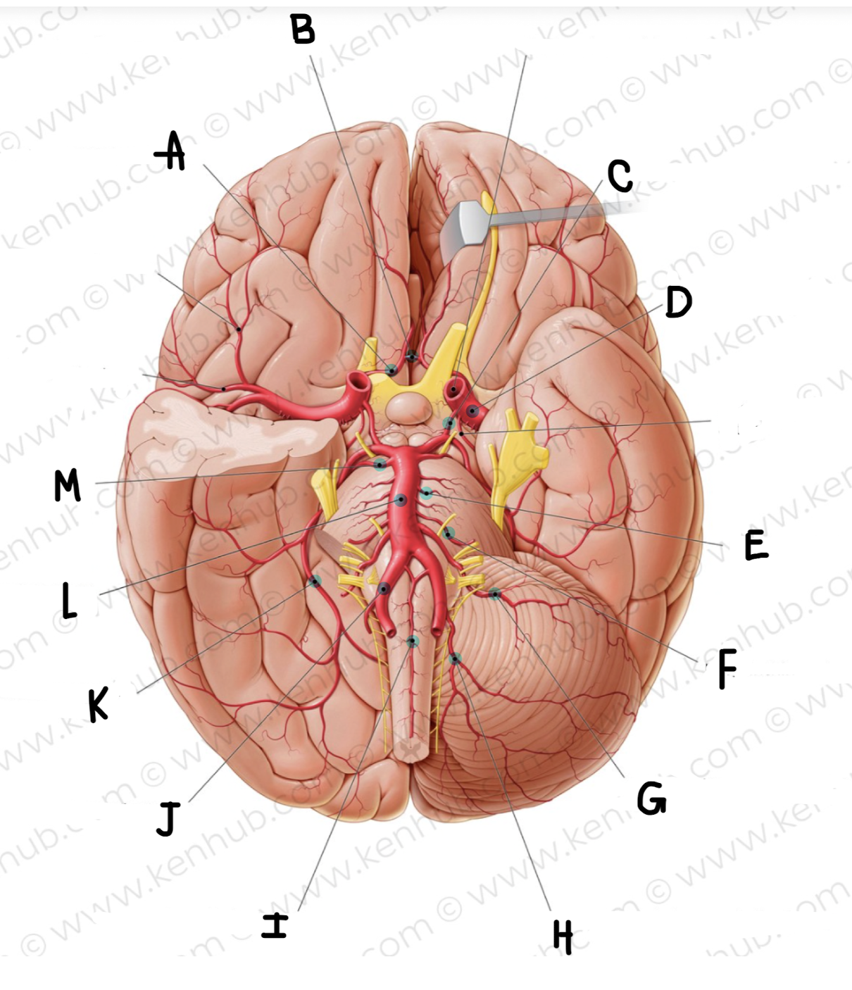 <p>What is the name of the artery labeled I?</p>