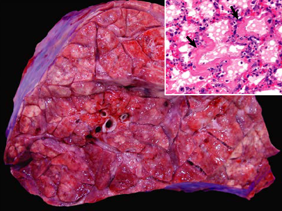 <p>Dairy cow, winter. What type of hypersensitivity is this most likely? </p><p>a. Type I hypersensitivity </p><p>b. Type II hypersensitivity </p><p>c. Type III hypersensitivity </p><p>d. Type IV hypersensitivity </p>