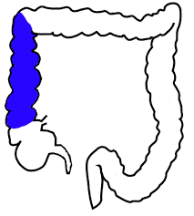 <p>ascending colon</p>