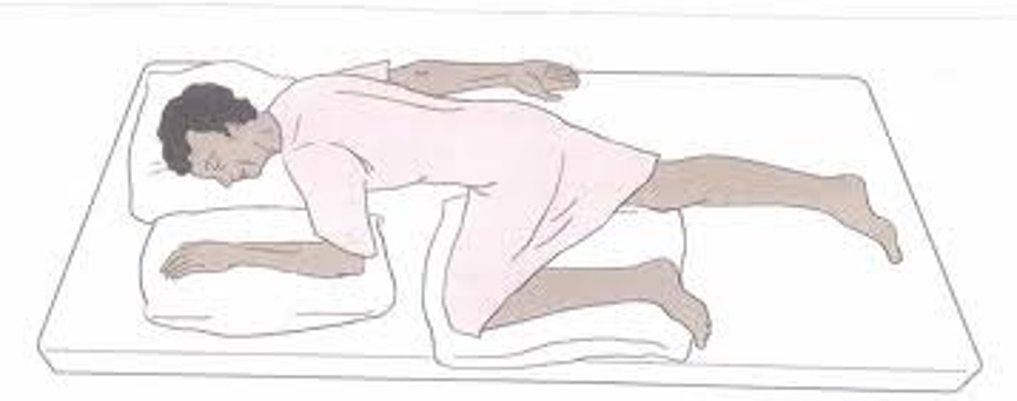 <p>Prone position with flexed hip openness perineum.</p><p>For: Rectal temperatures, cleaning bowel movement, etc</p>
