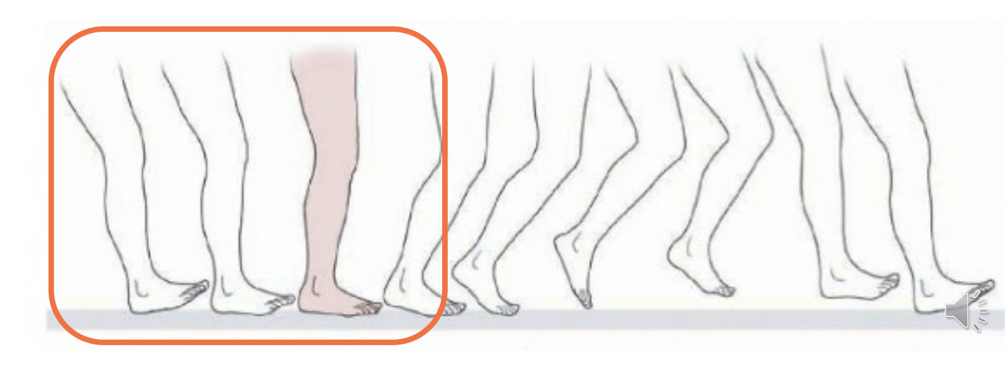 <p>Functional Lengthening</p>