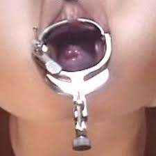 <p>Violet/blue color of the vaginal mucosa and cervix from increased vascularity</p>