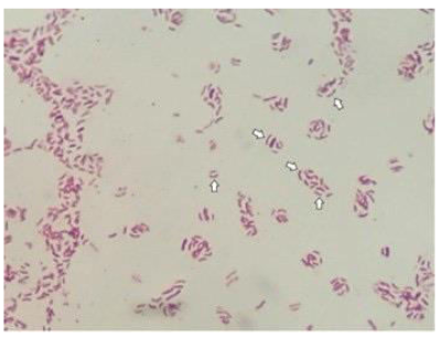 <p>Identify the morphology pointed at.</p>