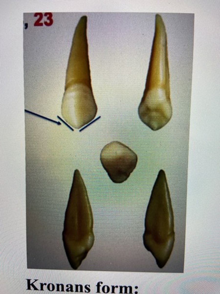 <p><span><u>Kronans form</u></span></p><ul><li><p>En kusp, två skänklar, mesiala är kortare</p></li><li><p><em>bred i mesiodistal riktning</em></p></li><li><p>kraftiga limbi och cingulum</p></li><li><p><em>bred och kraftig labial krista</em></p></li><li><p><em>tydlig platina krista</em></p></li><li><p><em>tydligt böjningstecken</em></p></li><li><p>ingen kronflykt</p></li></ul><p><span><u>Storlek</u></span></p><ul><li><p>bettets längsta tand (krona + rot)</p></li><li><p>kraftig rot</p></li></ul><p></p>