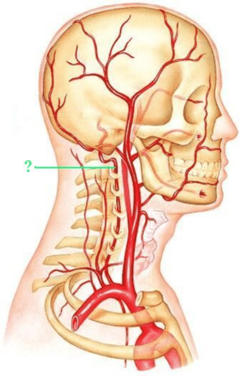 <p>Identify the indicated blood vessel.</p>