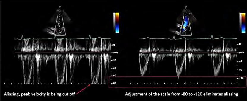 <p><strong>range of V displayed</strong></p><p>maximize waveform w/out aliasing</p>
