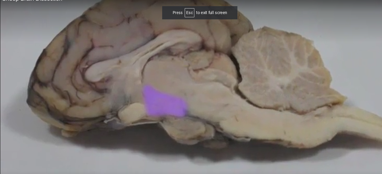 What part of the brain is this called?