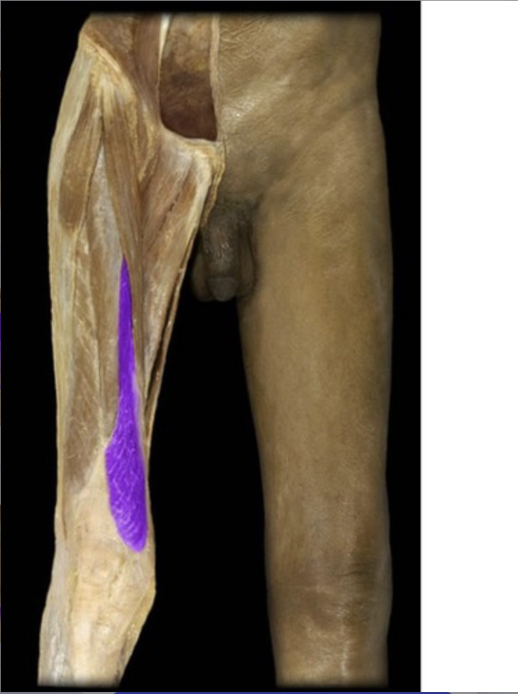 <p><em>Quadriceps muscle, table 5, 7</em></p>