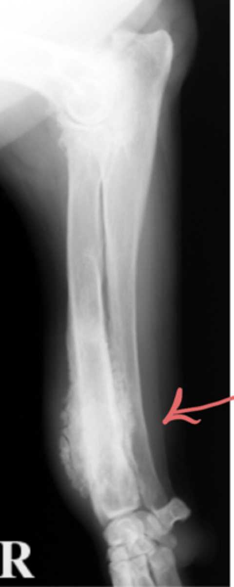 <p>Erosive or non erosive?</p>