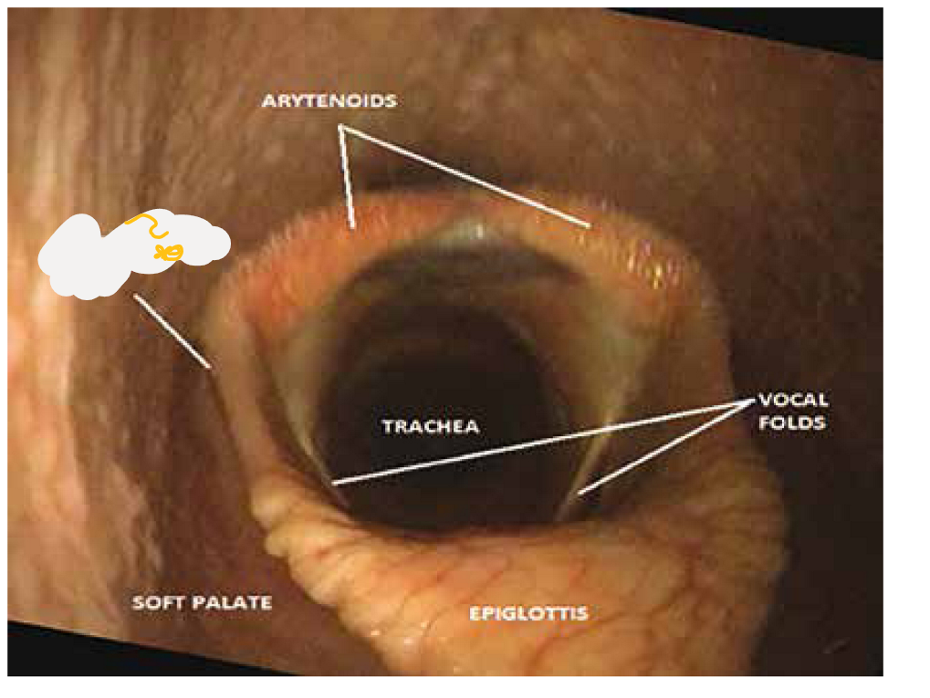 <p>this structure of cavum laryngis is?</p>