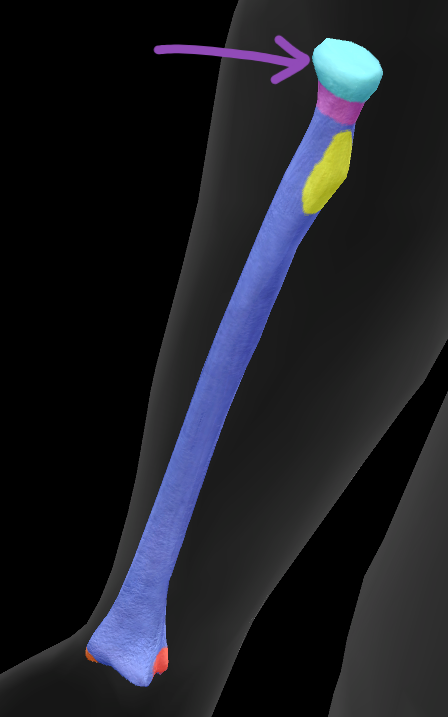 term image